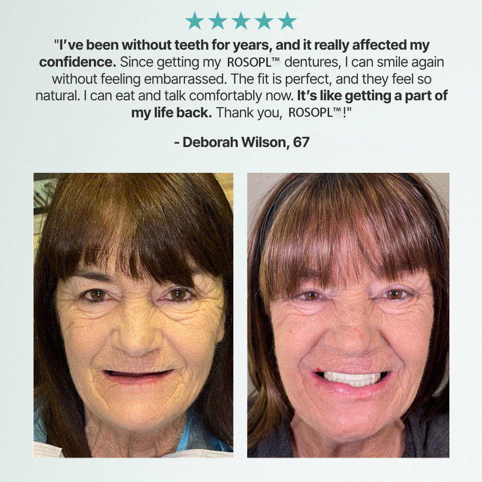ROSOPL DENTURES-Boil-and-Bite Functional Denture, Self-fit at Home, Fully Adjustable for Narrow or Wide Arches💋